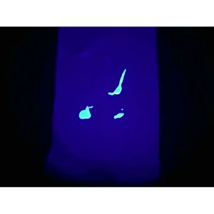 ФИЛИН LED HDi Люминоскоп с камерой 5 Мп и микрокомпьютером — изображение 3