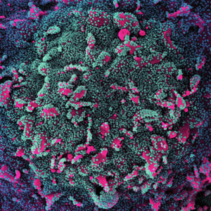 Экспресс-тесты на микробиологию